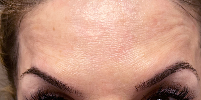 after botox Mc Modern Skin Shoreline 5105b